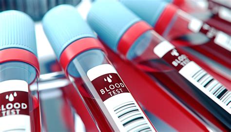 Search Continues For Blood Test To Detect Alzheimer S