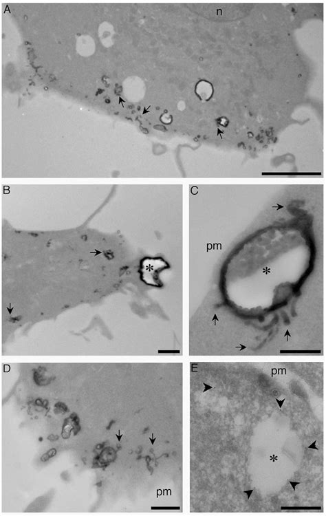 Figure From Visualisation Of Macropinosome Maturation By The