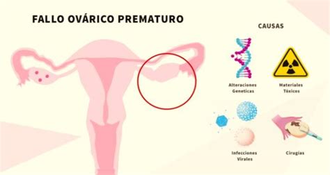 Insuficiencia Ovárica Prematura La inusual condición que afecta a