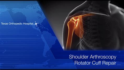 Rotator Cuff Repair Shoulder Arthroscopy By Dr Gombera Full Surgery