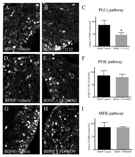 Bdnf Induced Cgrp Expression Was Mediated By The Plcg Pathway But Not