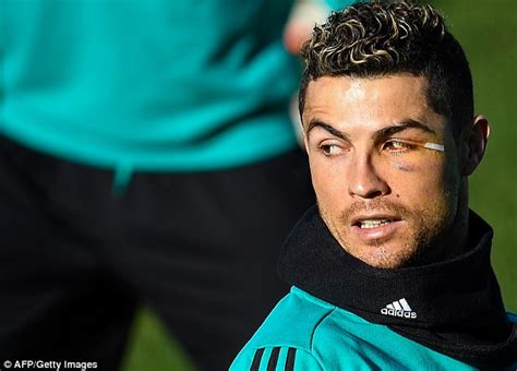 Cristiano Ronaldo: I'm still handsome after facial injury | Daily Mail ...