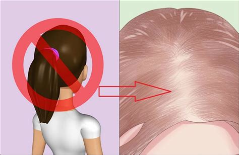 How To Stop Thinning Hair From Stress A Complete Guide The Definitive