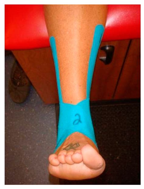 Jfmk Free Full Text Effect Of Kinesio® Taping On Ankle Complex