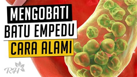 7 Cara Alami Mengobati Batu Empedu Tanpa Operasi Youtube