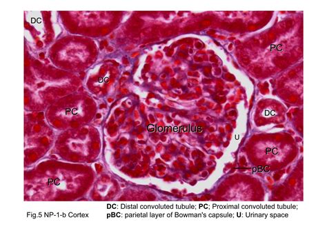 Merkel Discs Histology / Skin - Slide #4 : Here, the myocardial cells ...