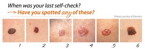 May Is Skin Cancer Awareness • Rejuvent Medical Spa And Surgery Scottsdale