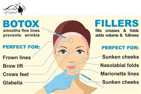 Botox VS Fillers: Why Dermal Fillers Are Better - Yastrid Medical ...