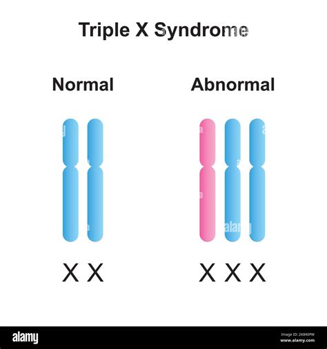 Scientific Designing Of Triple X Syndrome Trisomy X Colorful Symbols