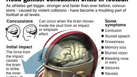 NFL standardizes concussion protocol - Newsday