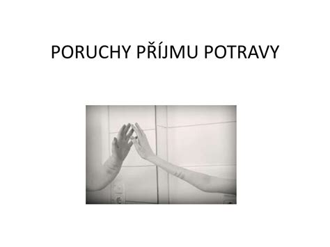 PPT PORUCHY PŘÍJMU POTRAVY PowerPoint Presentation free download