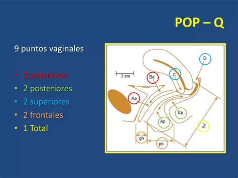 Clasificación Pop Q Ppt