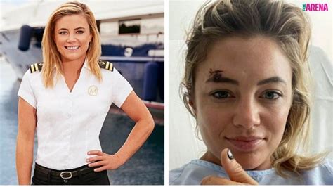 Below Deck Mediterranean Malia White Reveals How She S Coping After Shock Road Accident