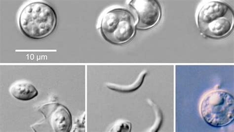 Multistate Cyclospora Outbreak | Office of Readiness and Response | CDC