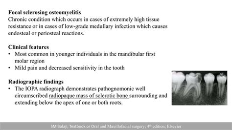 Osteomyelitis Of Jaw Ppt