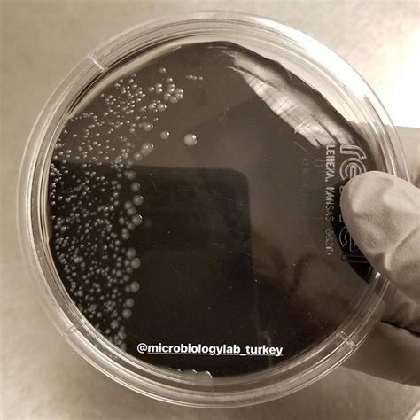 Legionella On Bcye Agar 🔬🖤😍 Mikrobiyoloji Microbiology Microbiologia Microscope Laboratuvar