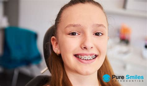 Five Tips To Make Your First Week Of Braces Easier Austin Tx