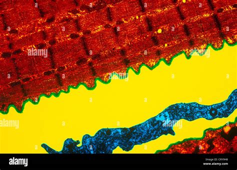 Skeletal muscle fiber microscope hi-res stock photography and images ...