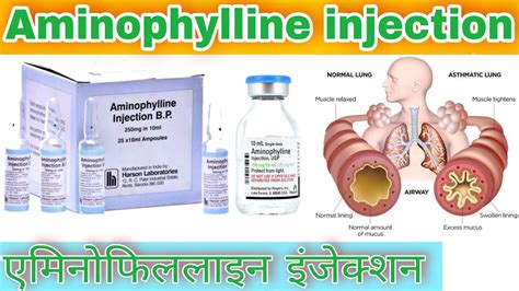 Aminophylline injection uses,dose,side-effects | Aminophylline ...