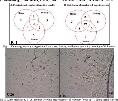 Figure 1 From Modified Culture Methodology For Specific Detection Of Blastocystis Hominis In