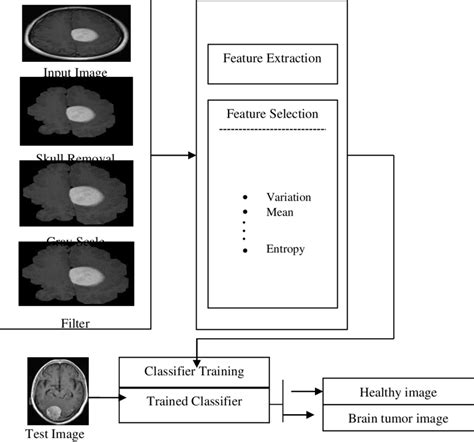 The proposed Brain Tumor Diagnosis Method. | Download Scientific Diagram