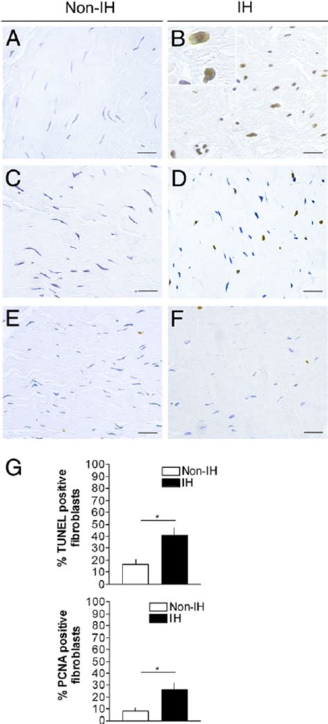 Apoptosis And Cell Proliferation Markers In Fascia Tissue Terminal