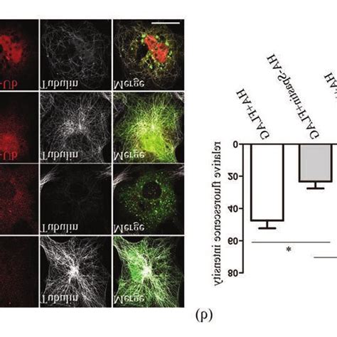 Flag Tagged Ubiquitin Suppresses The Microtubule Severing Activity Of