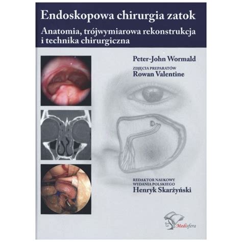 Endoskopowa chirurgia zatok Anatomia trójwymiarowa rekonstrukcja i