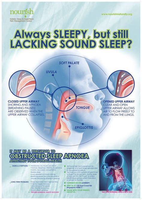 Sleep Apnoea Treatment Singapore Nourish Tmj Care