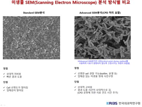 주사전자현미경과 투과전자현미경의 차이 및 특징 한국의과학연구원 미생물분석센터 네이버 블로그