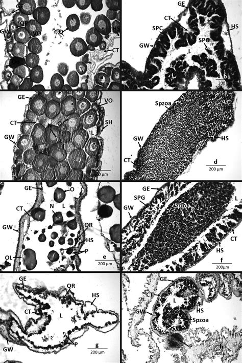 Stages Of Gonadal Development In Gonads Of Females A C D F And