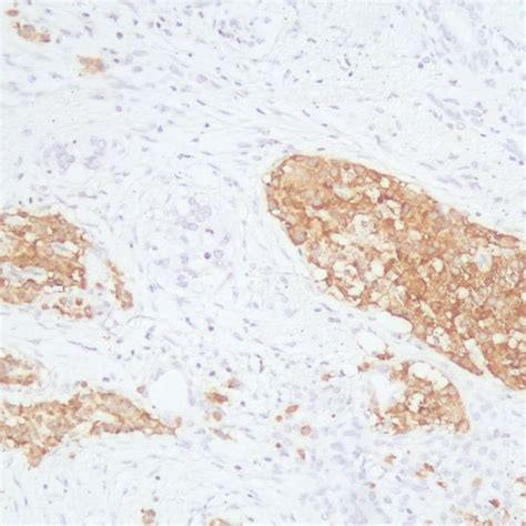 Synaptophysin Antibody Reagent For Immunohistochemistry Primary