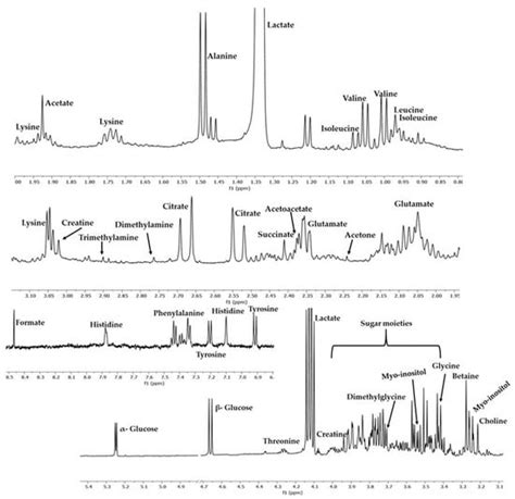 Metabolites Free Full Text Metabolomic Profiling Of Second Trimester Amniotic Fluid For