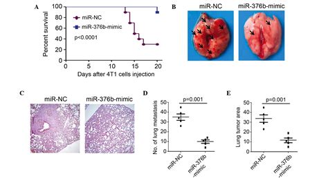 Microrna B Promotes Breast Cancer Metastasis By Targeting Hoxd