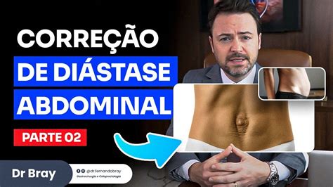 Corre O De Di Stase Abdominal Pt Youtube