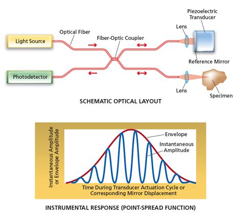 Stratus Optical Coherence Tomography Scenebro