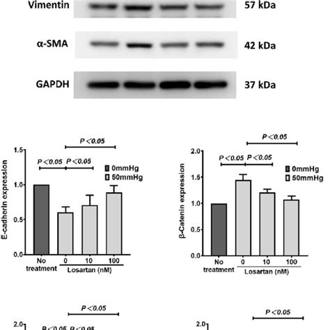 The Expression Of E Cadherin Catenin Vimentin And Sma In Human