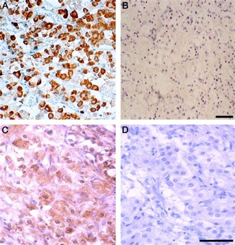 Immunolocalization Of Ghrelin And Its Functional Receptor The Type 1a