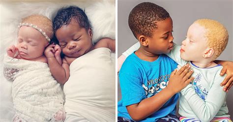 How a Mom Ended Up With Black and White Twins After Struggling With ...