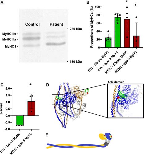 Myosin Post Translational Modifications And Function In The Presence Of