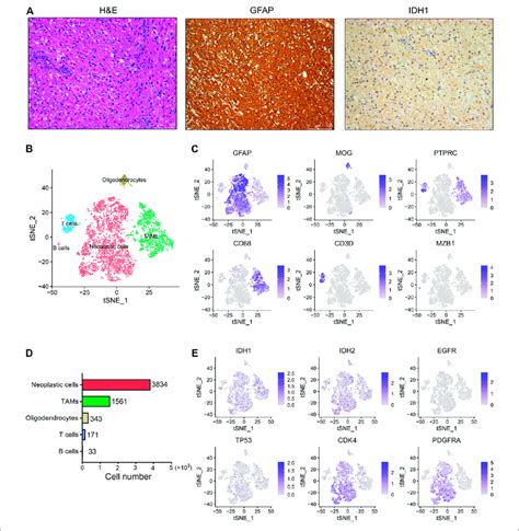 | The single-cell landscape of an IDH wild-type glioma. (A ...