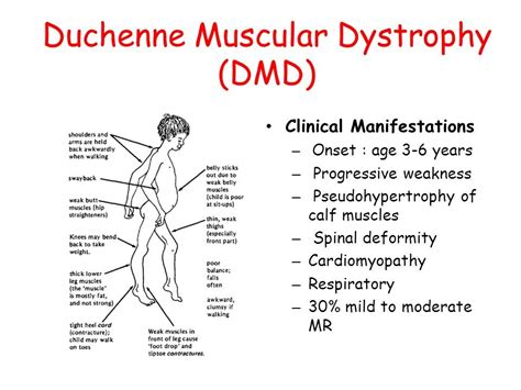 GNRS 515 Patho Alterations In Muscular Development DMD Diagram Quizlet