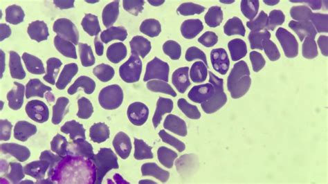 Babesia Canis In Blood Smear Youtube