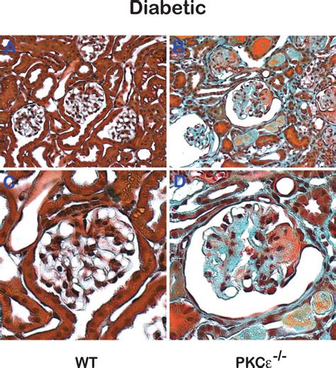 Streptozotocin Stz Induced Diabetes Wk Diabetes Duration Leads To