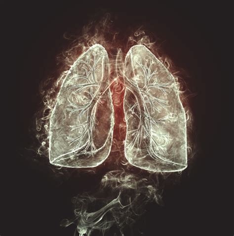 Coal Miner's Black Lung Disease is on the Rise Again, CDC Study Shows