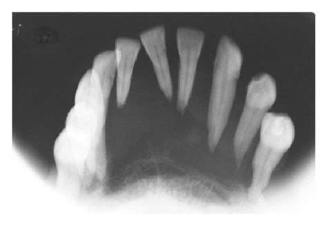 A B Clinical Aspects Of The Maxilla And Mandible Lesions