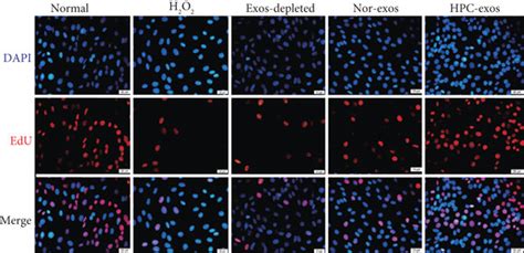 Hpc Exos Promote Cardiac Endothelial Cell Migration Proliferation And