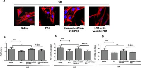 Protectin D1mirna 210 Axis Regulates Hypoxia Induced Hypertrophy In