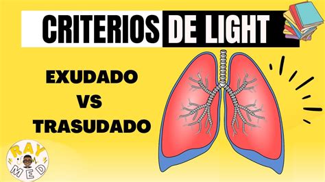 Derrame Pleural Criterios De Light YouTube