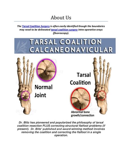 Tarsal Coalition Surgery